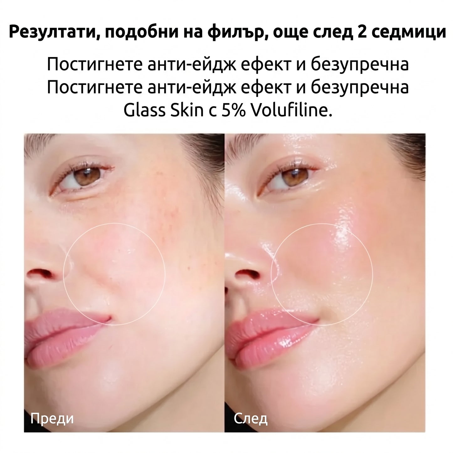Serum collagen