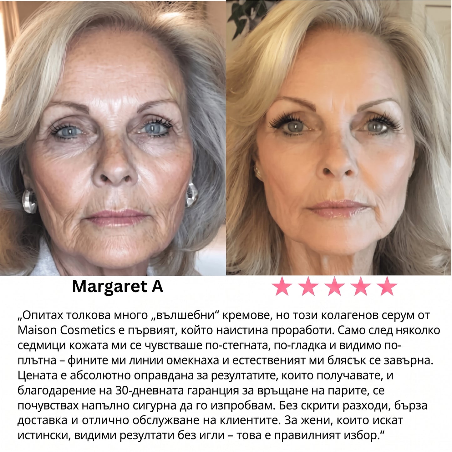 Serum collagen